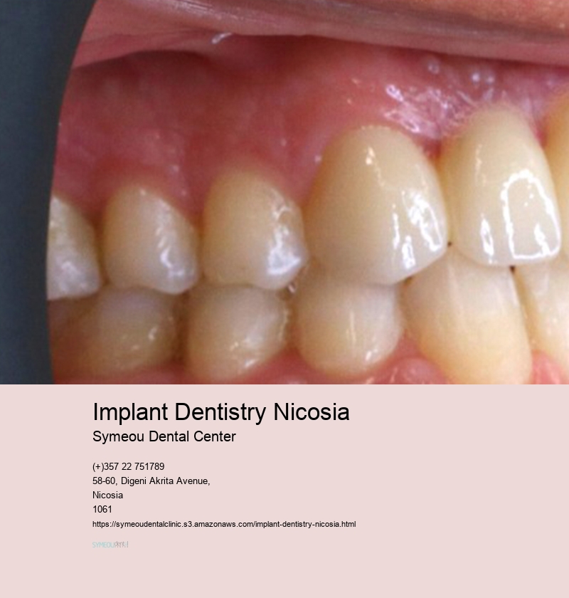 Implant Dentistry Nicosia