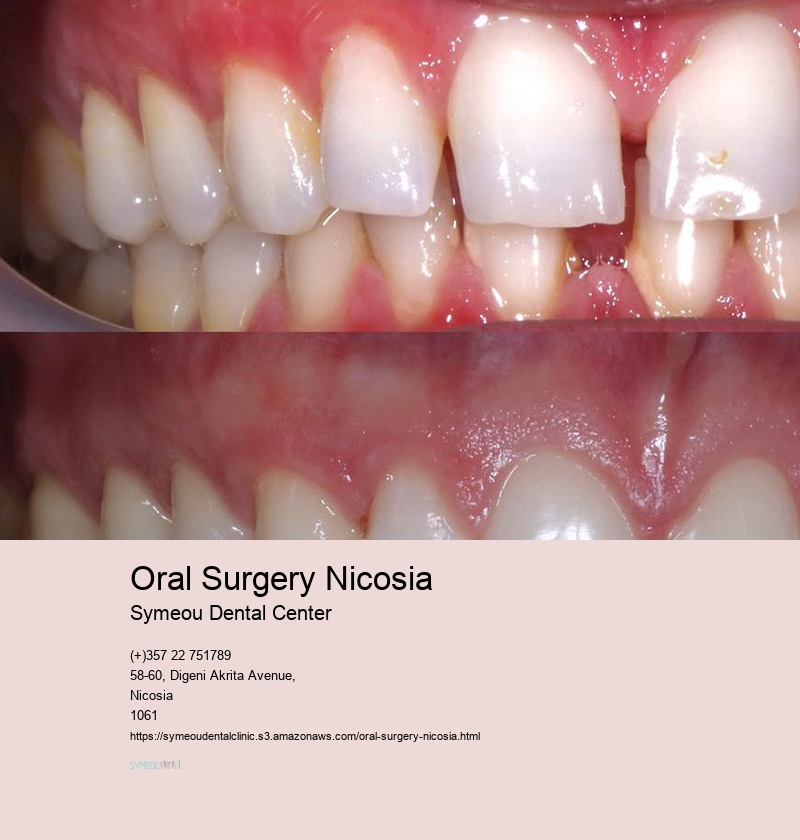 Oral Surgery Nicosia