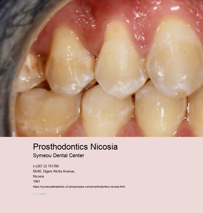 Prosthodontics Nicosia